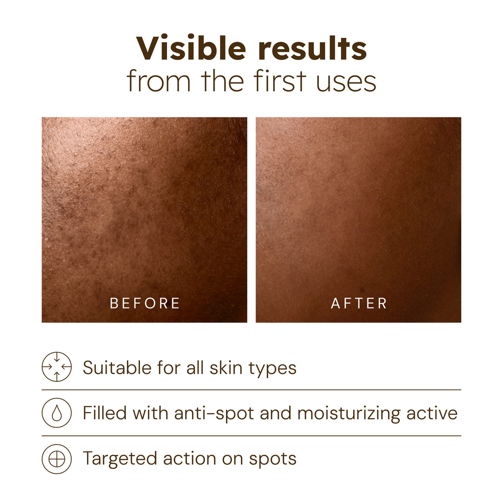 Anti-Blemish Serum